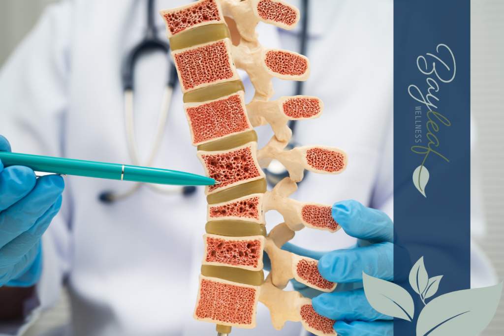 Osteoporosis - the silent killer