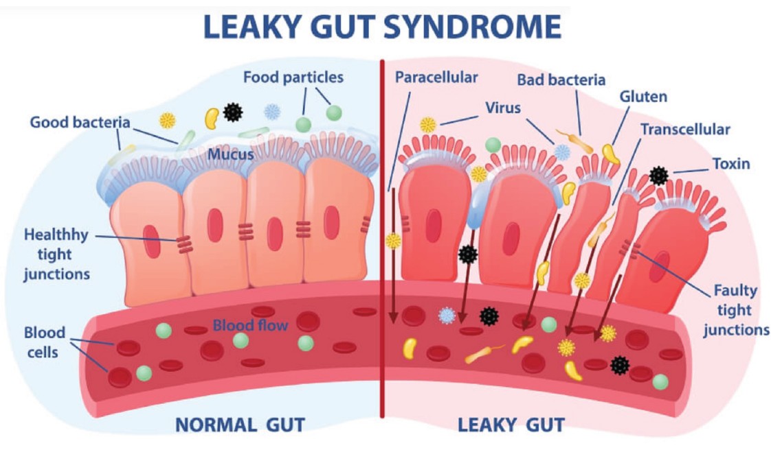 gut health